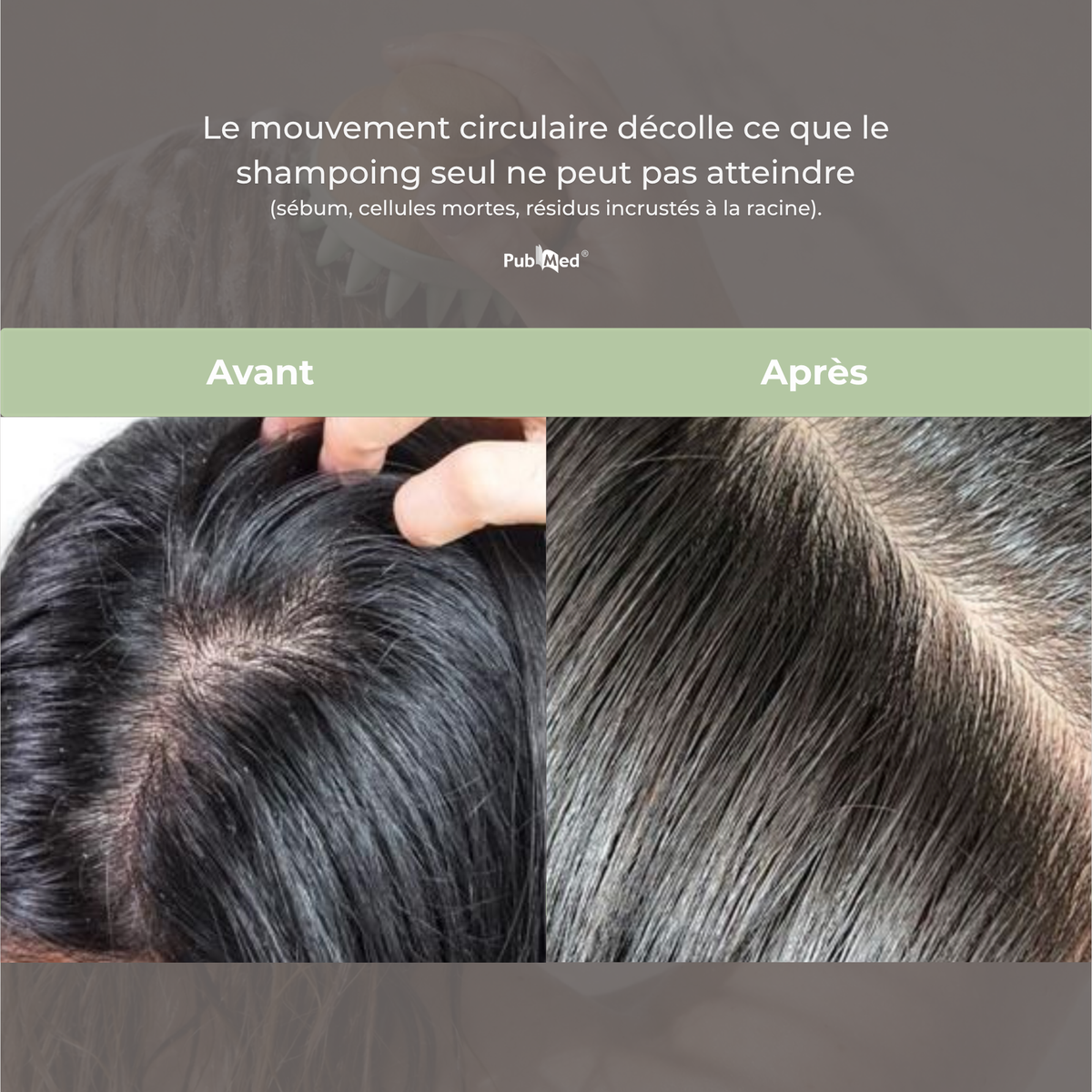 Brosse Rituel Massage Cuir Chevelu — Cheveux Gras